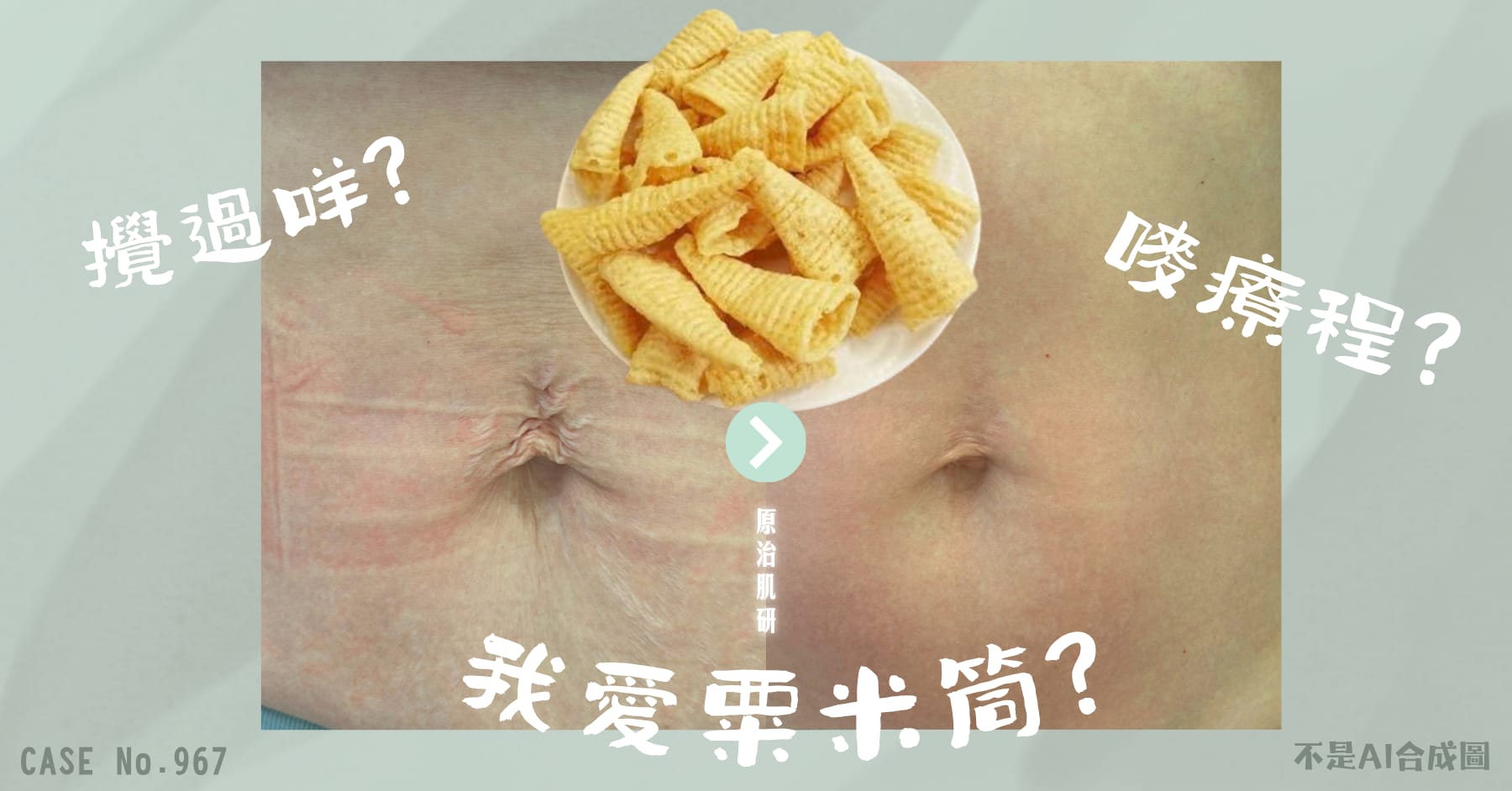 改善皮膚鬆弛細紋的初老救星 | InMode Forma 無創射頻療程